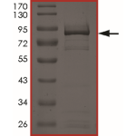 EGFR (d746-750 T790M) Protein